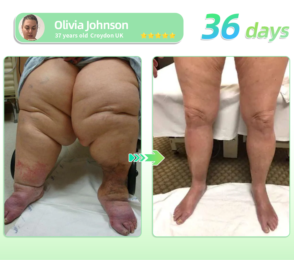 𝐇𝐇𝐕𝐁® Only 10 boxes left! ⏰ Score an exclusive 30% off today!  Endorsed by endocrinologists — 4 to 6 boxes recommended to keep the weight off and avoid rebound.  Last chance before the new year rolls around — don’t miss out! 🔥